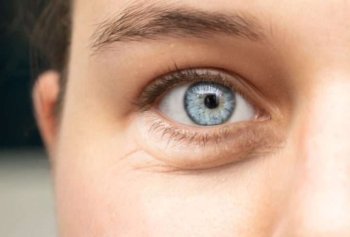 Oculoplasty