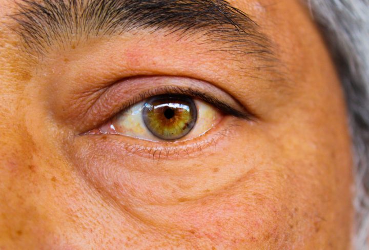 close-up-portrait-eye